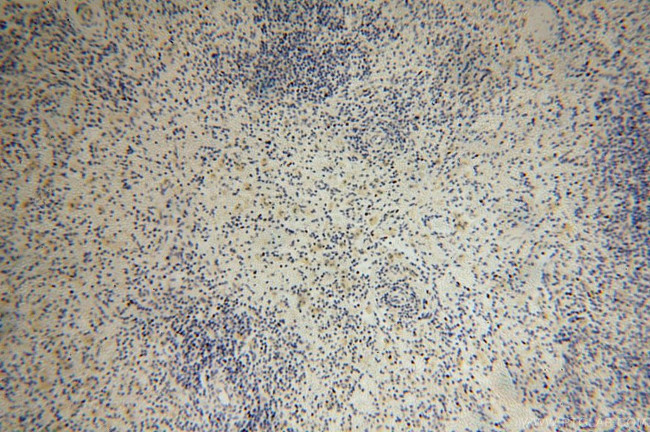 ARHGAP4 Antibody in Immunohistochemistry (Paraffin) (IHC (P))