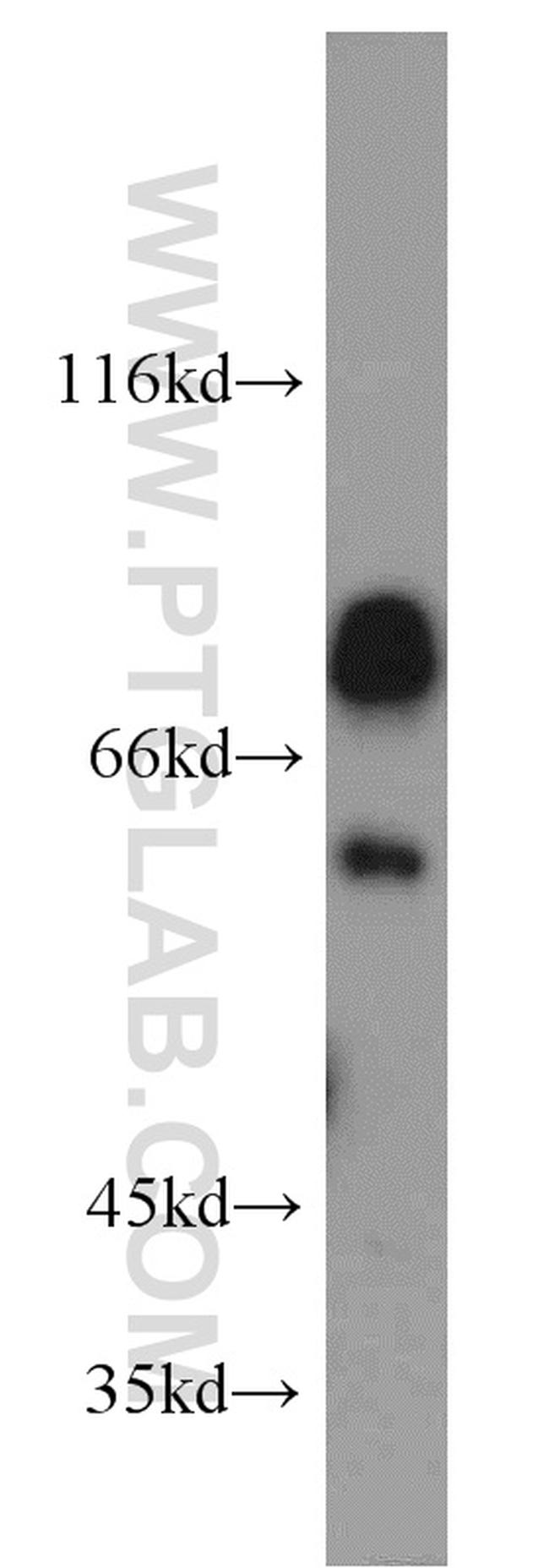 NKD2 Antibody in Western Blot (WB)