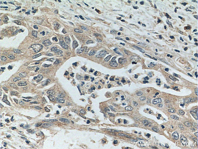 Glypican 1 Antibody in Immunohistochemistry (Paraffin) (IHC (P))