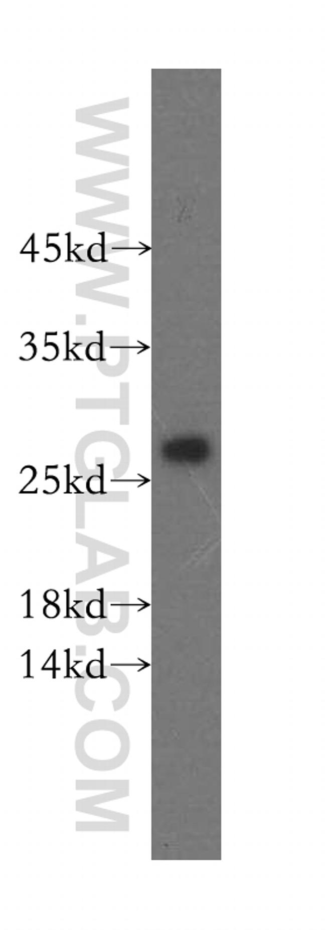 IDI2 Antibody in Western Blot (WB)