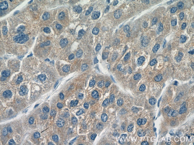 CYP20A1 Antibody in Immunohistochemistry (Paraffin) (IHC (P))