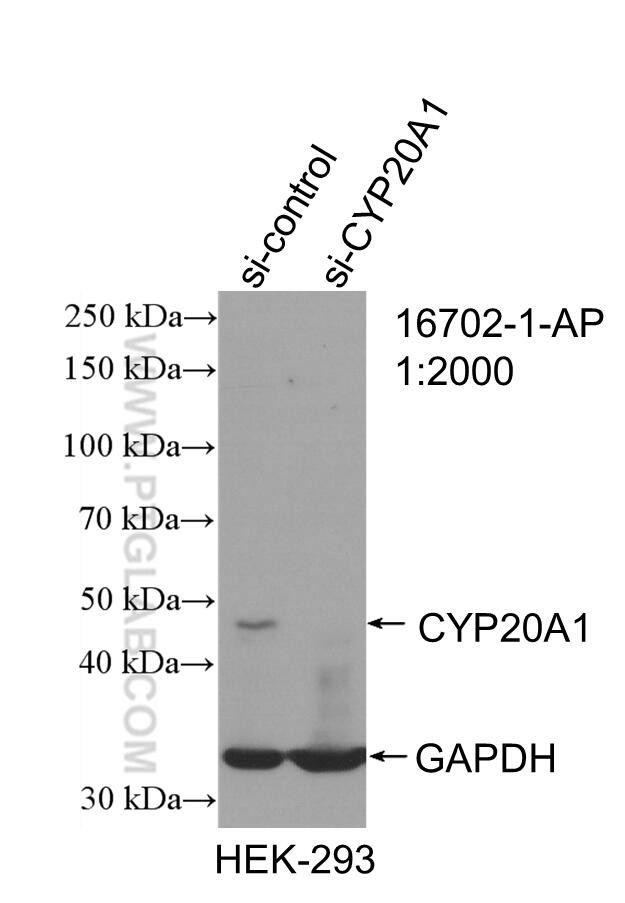 CYP20A1 Antibody in Western Blot (WB)