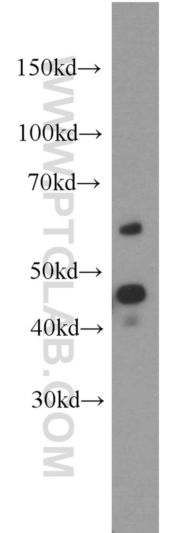 CYP20A1 Antibody in Western Blot (WB)