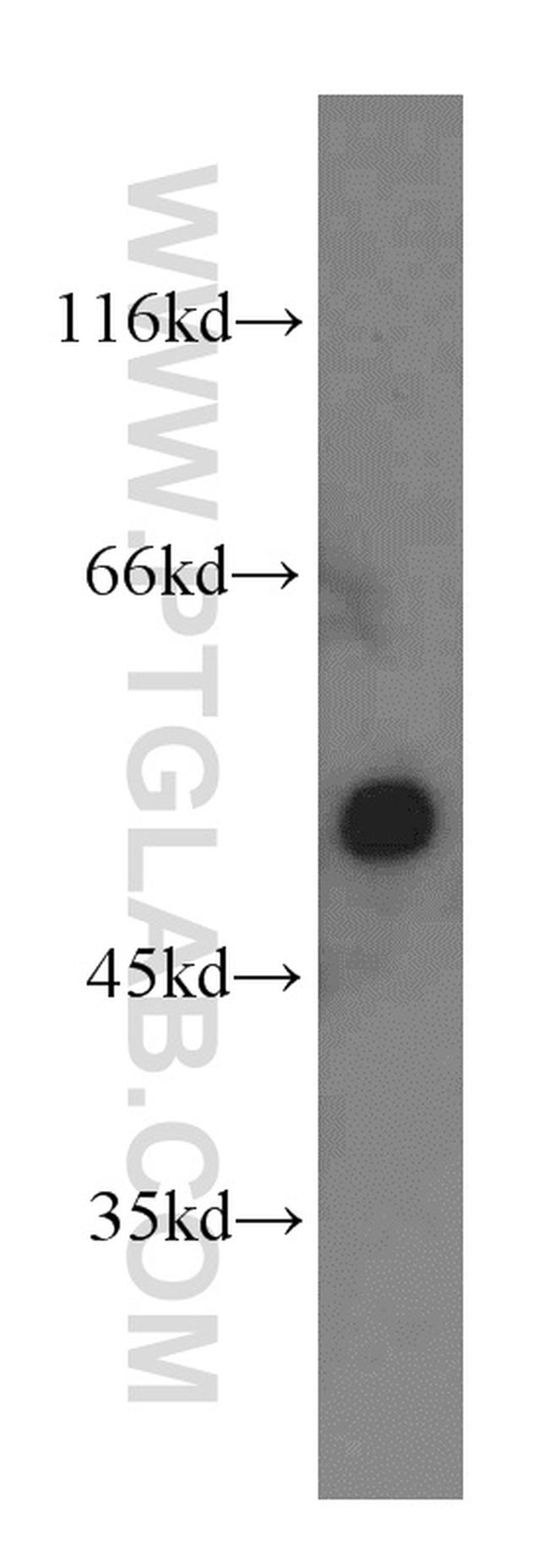 CYP20A1 Antibody in Western Blot (WB)