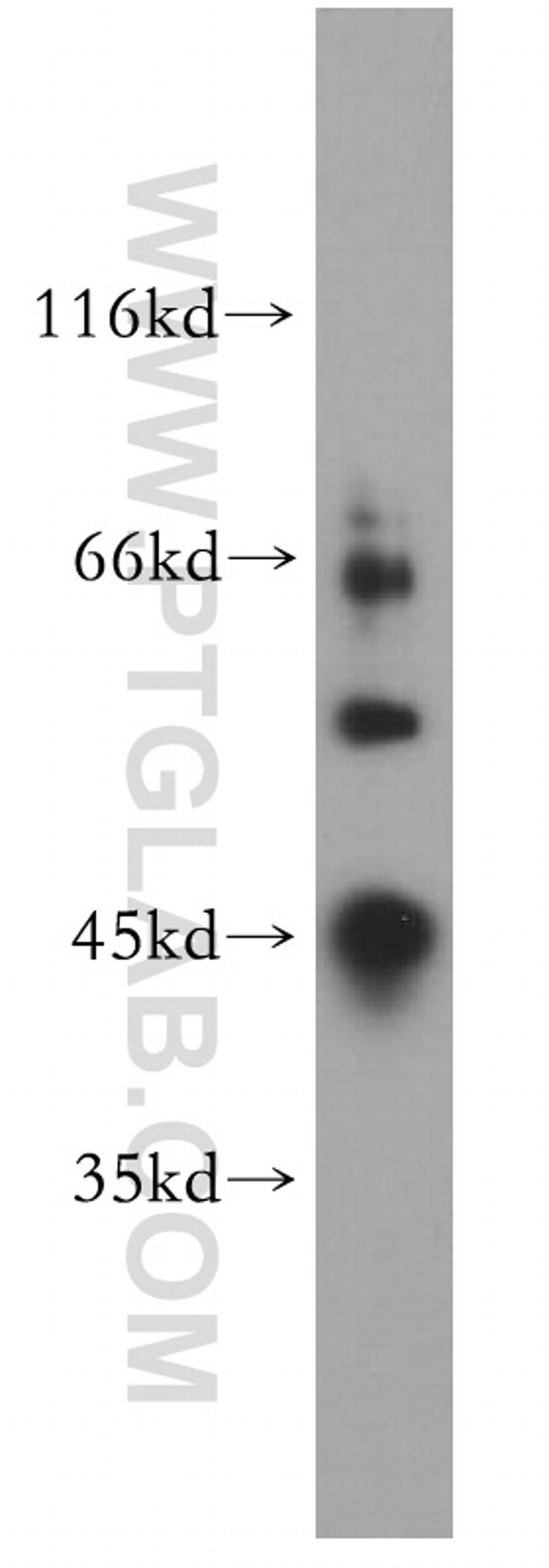 CYP20A1 Antibody in Western Blot (WB)