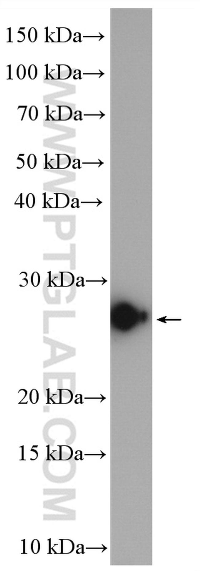 GSTA3 Antibody in Western Blot (WB)