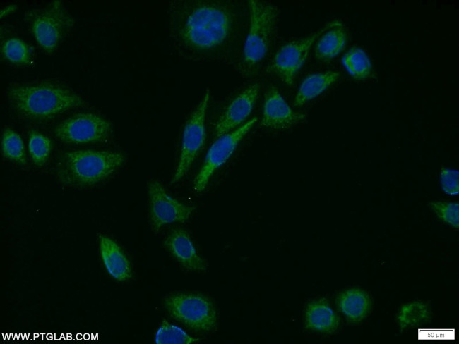 MTH1 Antibody in Immunocytochemistry (ICC/IF)