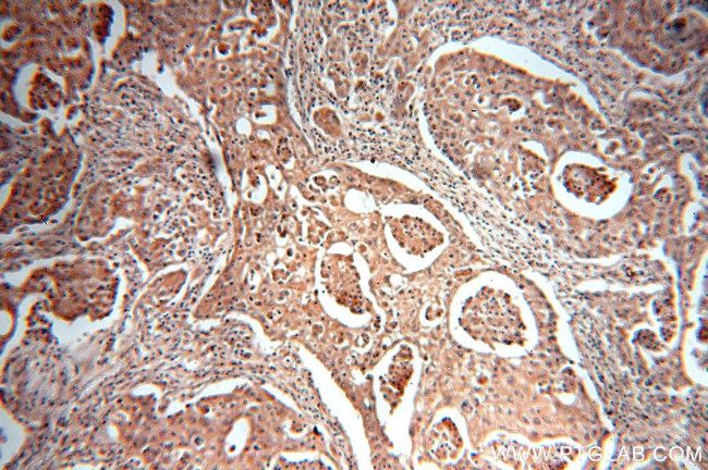 MTH1 Antibody in Immunohistochemistry (Paraffin) (IHC (P))