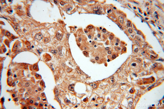 MTH1 Antibody in Immunohistochemistry (Paraffin) (IHC (P))