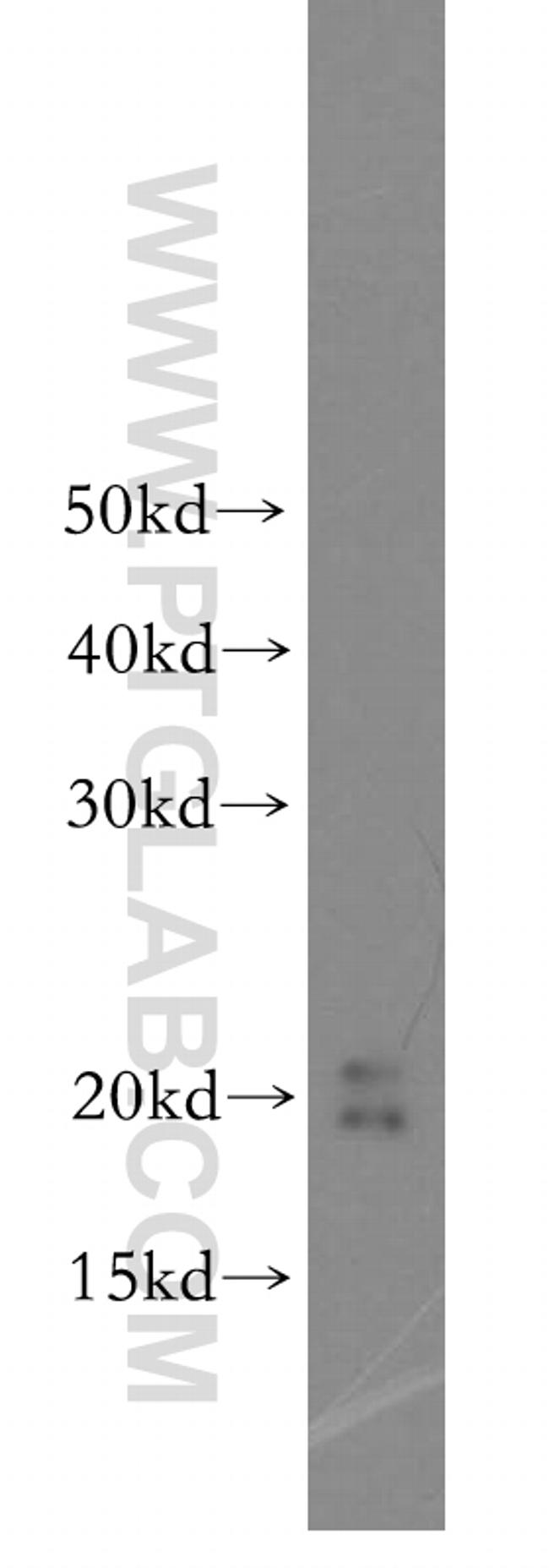 MTH1 Antibody in Western Blot (WB)