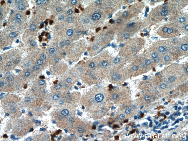 HBQ1 Antibody in Immunohistochemistry (Paraffin) (IHC (P))