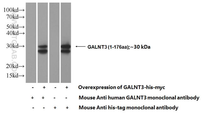 GALNT3 Antibody in Western Blot (WB)