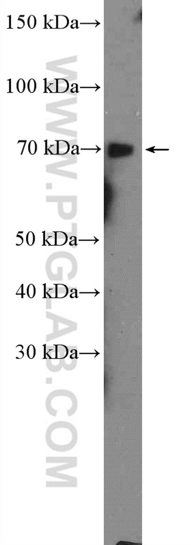 GALNT3 Antibody in Western Blot (WB)