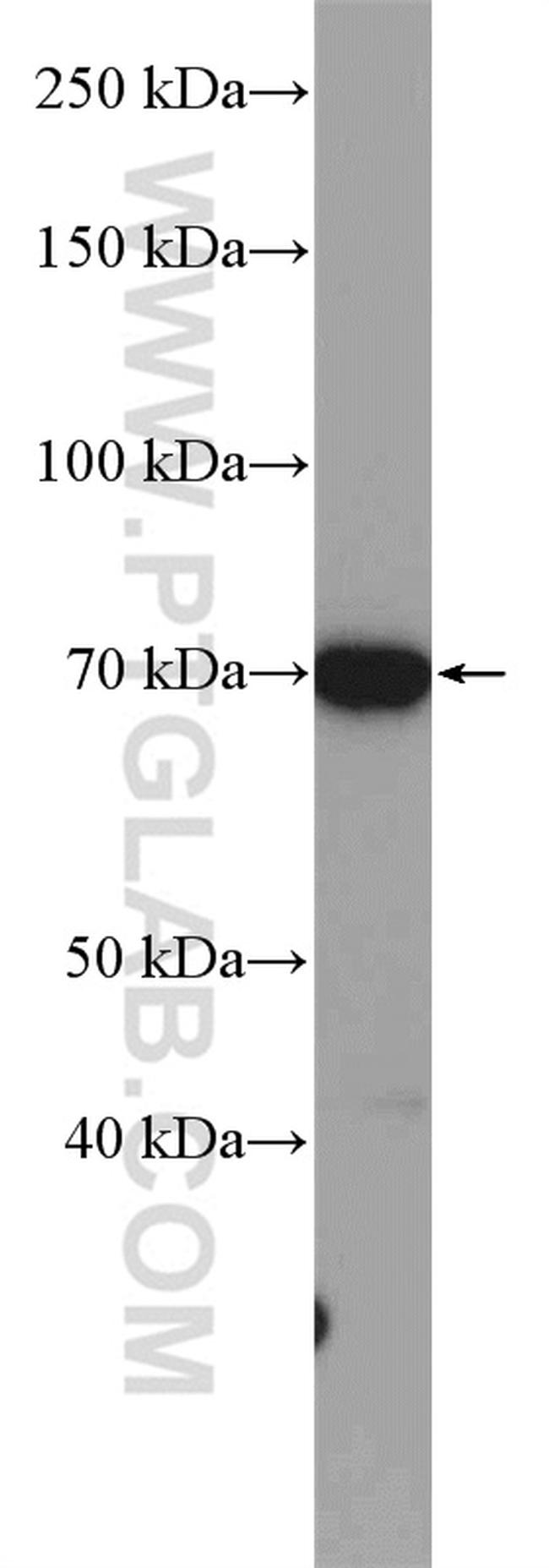 GALNT3 Antibody in Western Blot (WB)