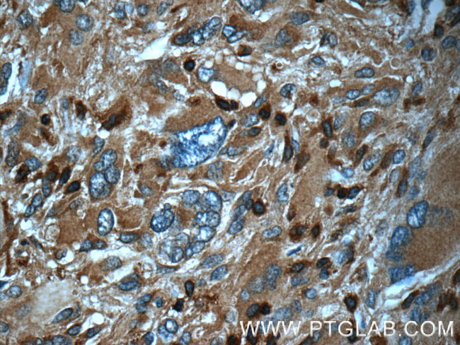 ARPC5 Antibody in Immunohistochemistry (Paraffin) (IHC (P))