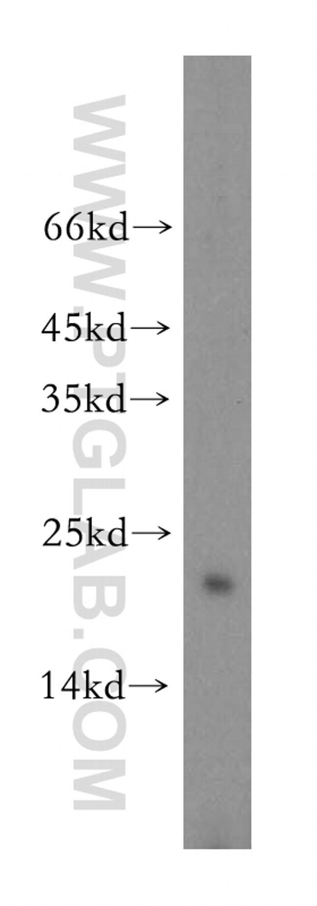 ARPC5 Antibody in Western Blot (WB)