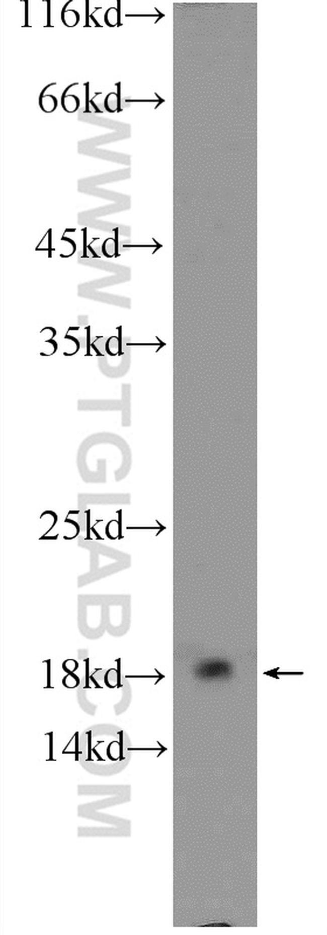 ARPC5 Antibody in Western Blot (WB)