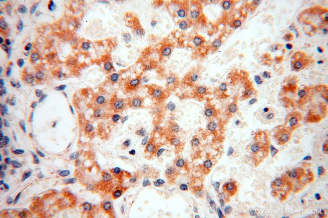 NDUFB11 Antibody in Immunohistochemistry (Paraffin) (IHC (P))