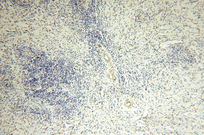 NDUFB11 Antibody in Immunohistochemistry (Paraffin) (IHC (P))