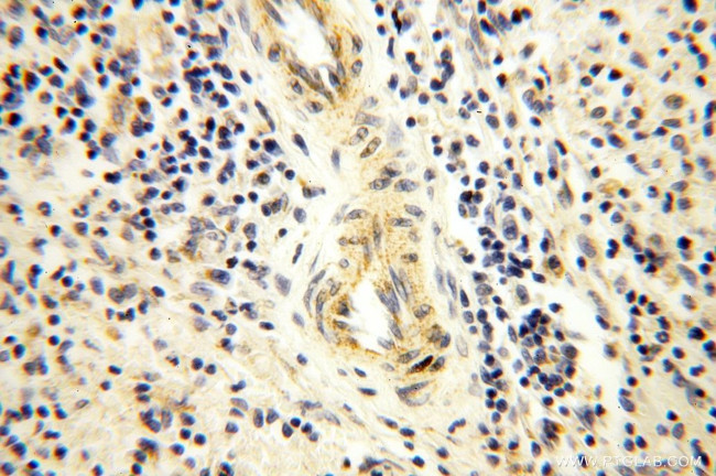 NDUFB11 Antibody in Immunohistochemistry (Paraffin) (IHC (P))