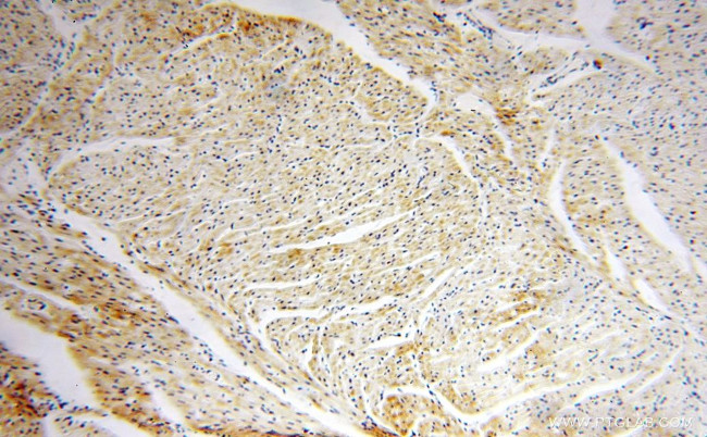 NDUFB11 Antibody in Immunohistochemistry (Paraffin) (IHC (P))