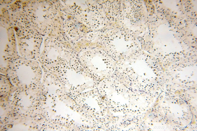 NDUFB11 Antibody in Immunohistochemistry (Paraffin) (IHC (P))