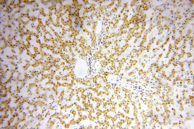 NDUFB11 Antibody in Immunohistochemistry (Paraffin) (IHC (P))