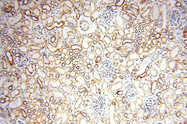 NDUFB11 Antibody in Immunohistochemistry (Paraffin) (IHC (P))