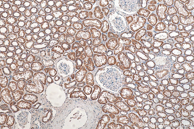 NDUFB11 Antibody in Immunohistochemistry (Paraffin) (IHC (P))