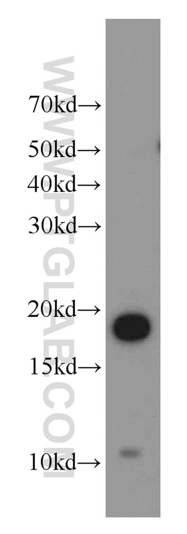 NDUFB11 Antibody in Western Blot (WB)