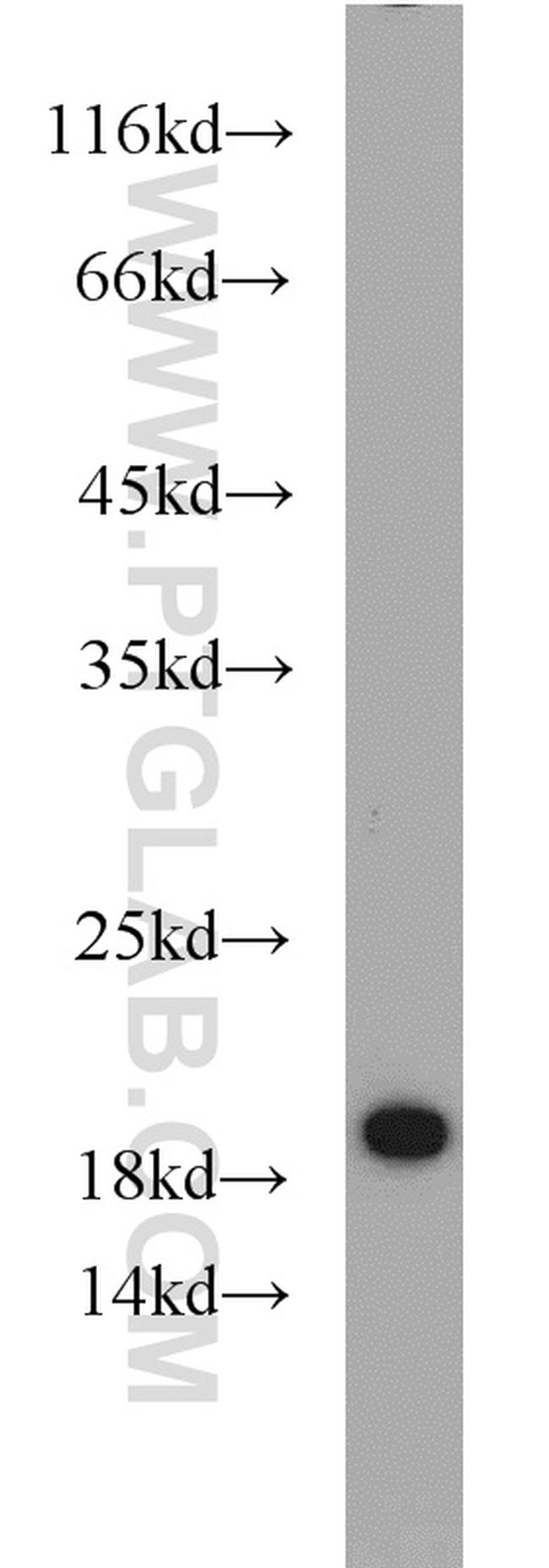 NDUFB11 Antibody in Western Blot (WB)