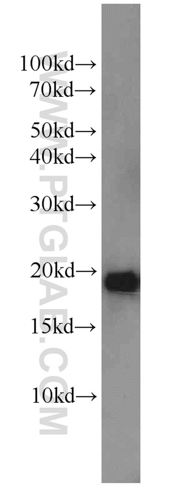 NDUFB11 Antibody in Western Blot (WB)