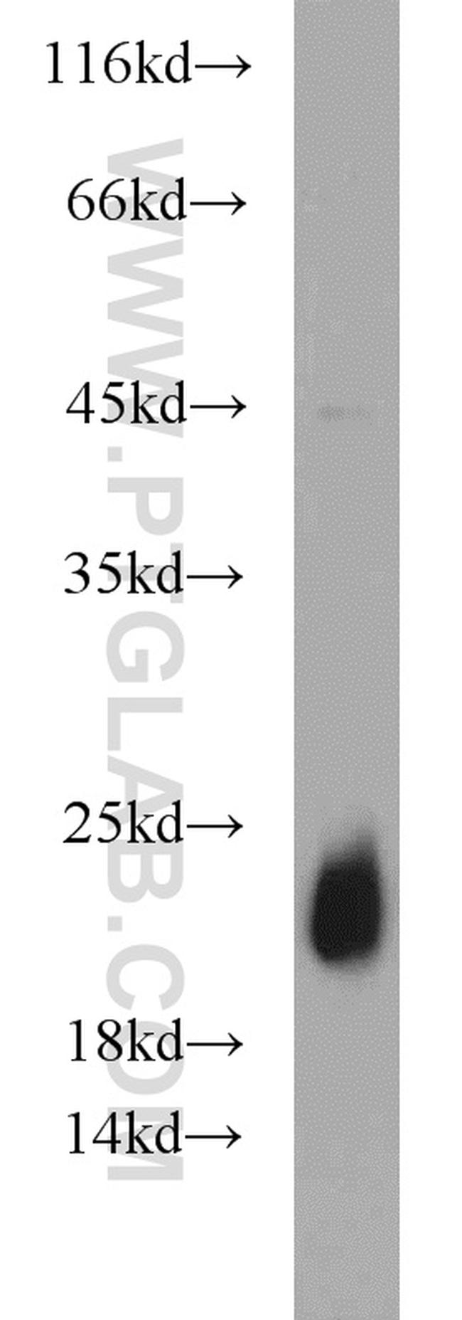 NDUFB11 Antibody in Western Blot (WB)