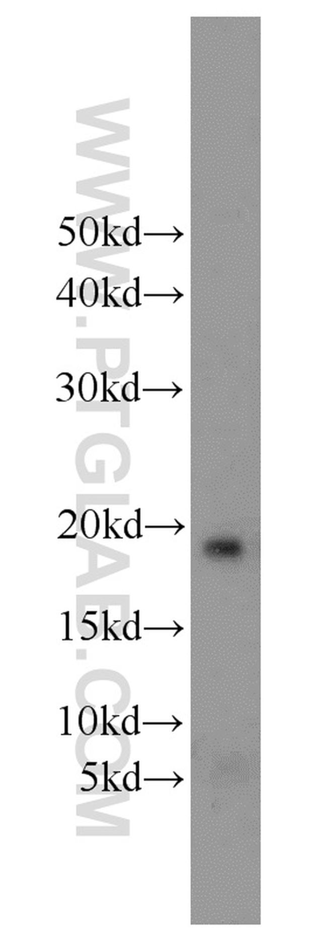 NDUFB11 Antibody in Western Blot (WB)