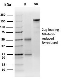 DCP2 (Decapping mRNA 2) Antibody in SDS-PAGE (SDS-PAGE)