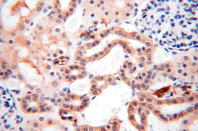 ANTXR2 Antibody in Immunohistochemistry (Paraffin) (IHC (P))