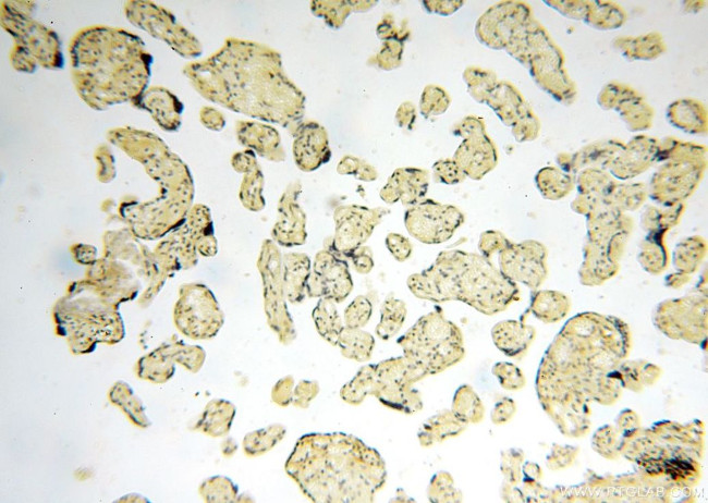 ANTXR2 Antibody in Immunohistochemistry (Paraffin) (IHC (P))