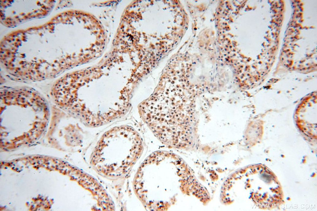 ANTXR2 Antibody in Immunohistochemistry (Paraffin) (IHC (P))