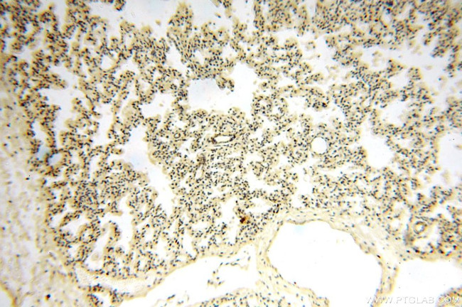 ANTXR2 Antibody in Immunohistochemistry (Paraffin) (IHC (P))