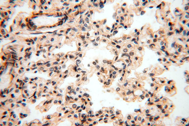 ANTXR2 Antibody in Immunohistochemistry (Paraffin) (IHC (P))