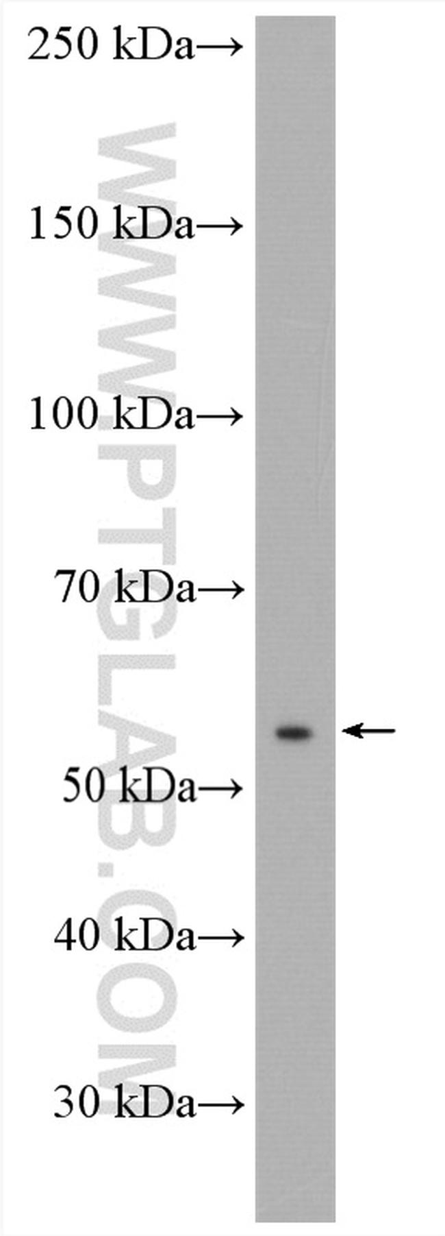 ANTXR2 Antibody in Western Blot (WB)