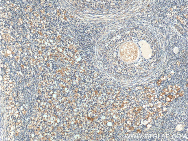 ANTXR2 Antibody in Immunohistochemistry (Paraffin) (IHC (P))