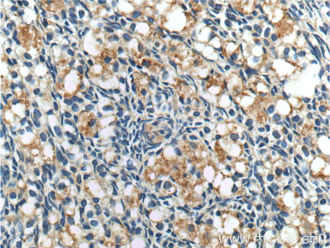 ANTXR2 Antibody in Immunohistochemistry (Paraffin) (IHC (P))