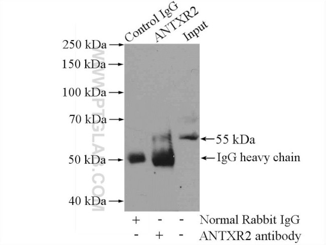 ANTXR2 Antibody in Immunoprecipitation (IP)