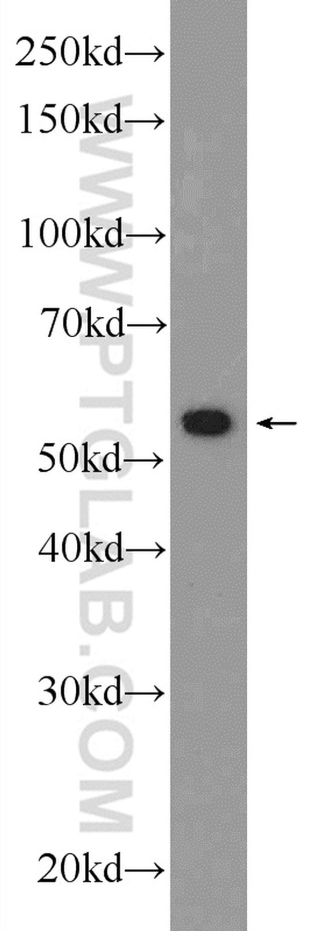 ANTXR2 Antibody in Western Blot (WB)