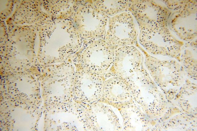 CPOX Antibody in Immunohistochemistry (Paraffin) (IHC (P))