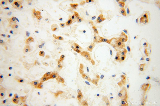 CPOX Antibody in Immunohistochemistry (Paraffin) (IHC (P))