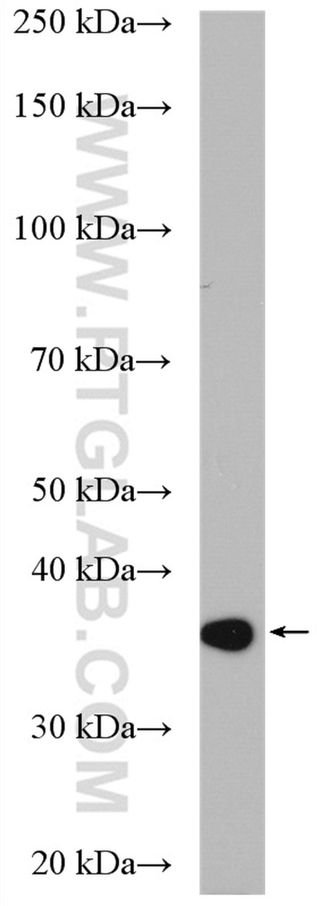 CPOX Antibody in Western Blot (WB)