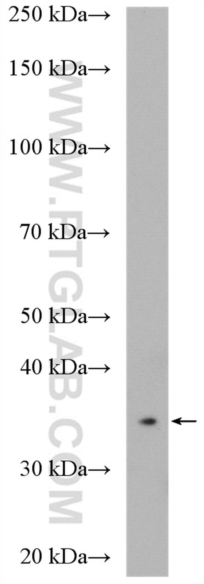 CPOX Antibody in Western Blot (WB)