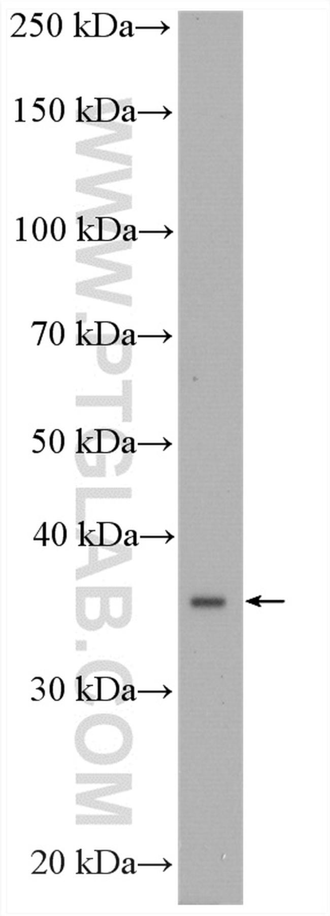 CPOX Antibody in Western Blot (WB)